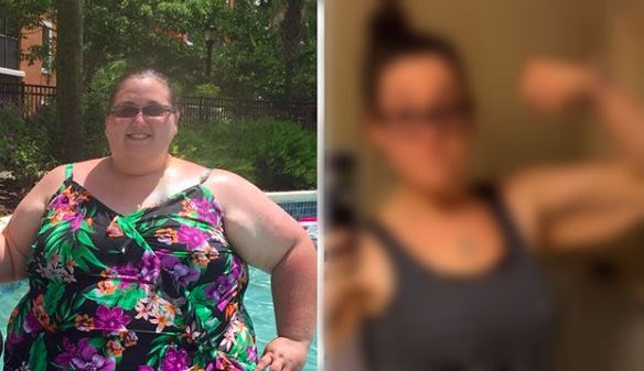 Izgubila je 150 kilograma, ali nije očekivala da će joj se ovo dogoditi