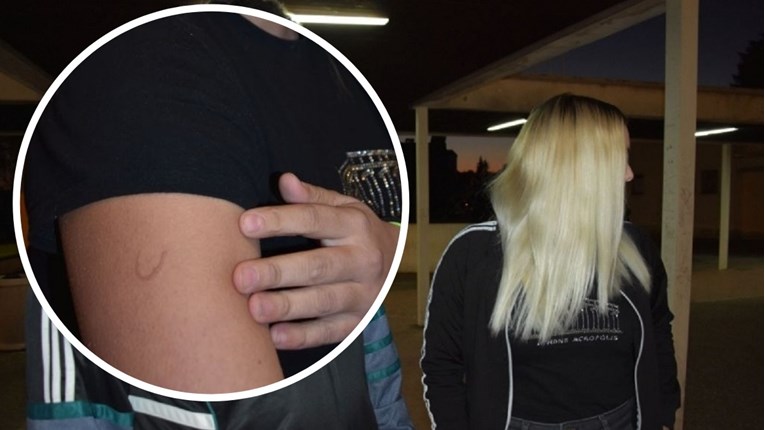 Zadarski učenik pokušao je žigosati lice tinejdžerice. Prebio joj je i sestru