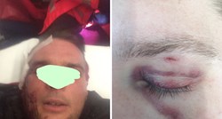 Policajac na maškarama u Vrbniku napao mještana i razbio mu čašu o glavu