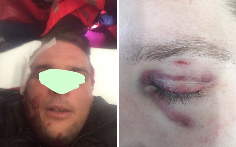 Policajac na maškarama u Vrbniku napao mještana i razbio mu čašu o glavu