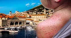 Potvrđen treći slučaj ospica u Dubrovniku
