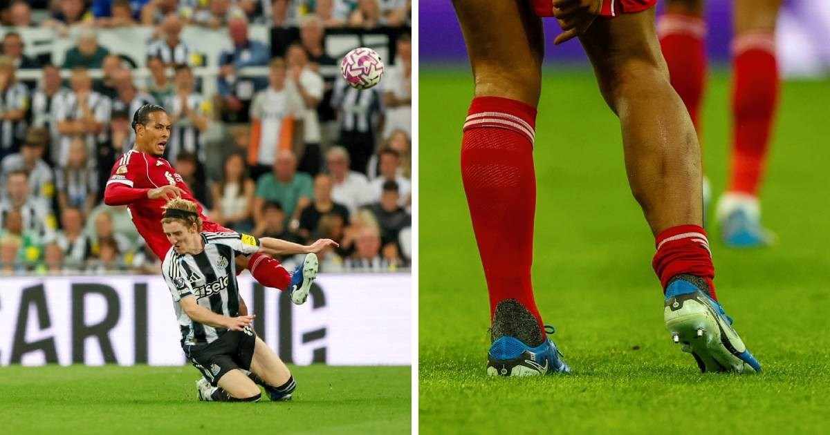 Pogledajte kako izgleda Van Dijkova noga nakon teškog starta za crveni u Premier ligi