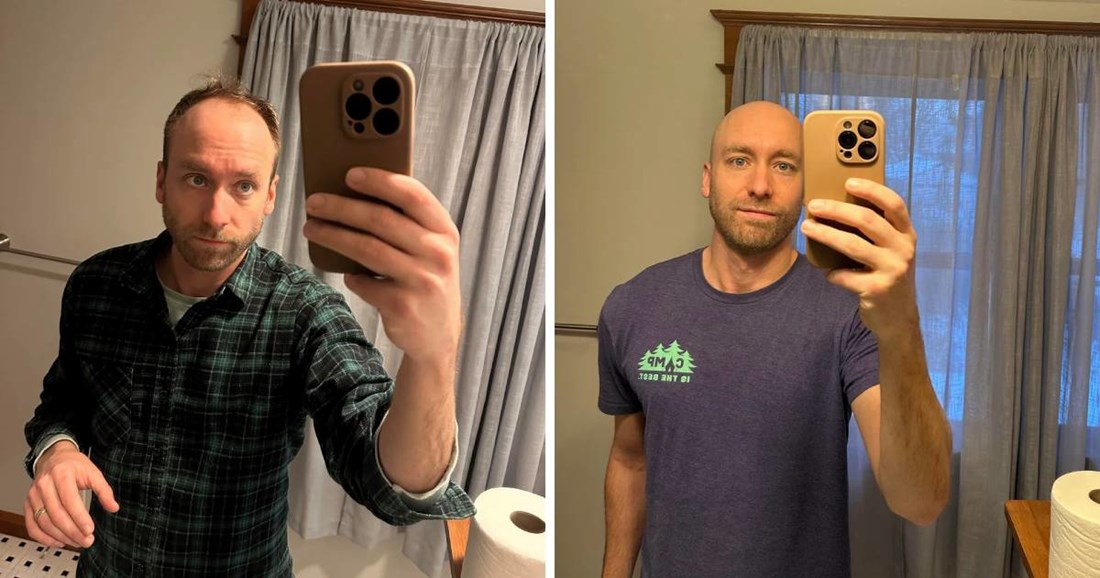 Počeo ćelaviti pa obrijao glavu, ljudi mu pišu da izgleda osam godina mlađe