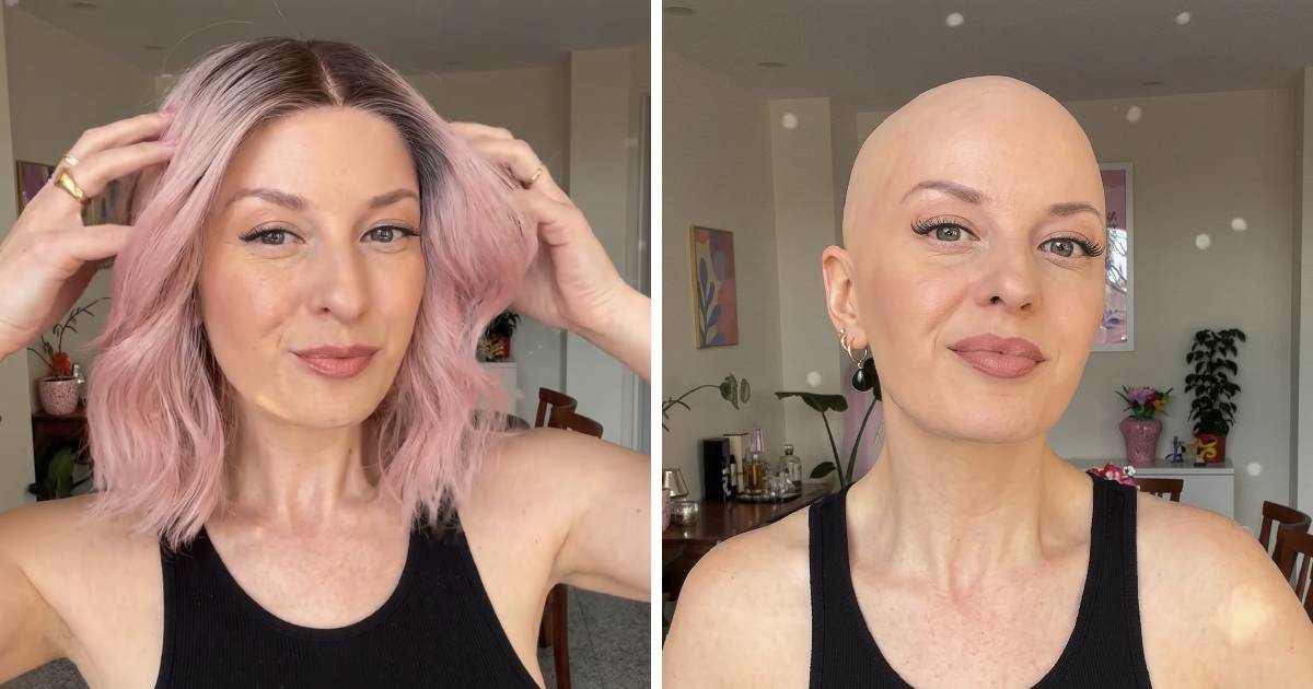 Nakon 30 godina skinula periku i izašla među ljude: "Kao da sam gola"