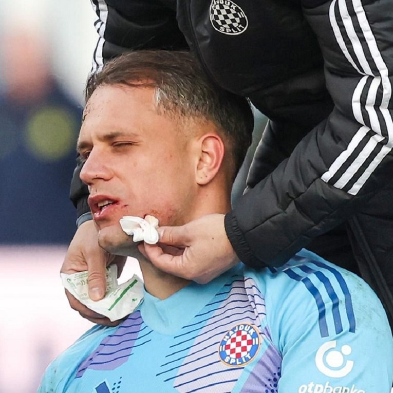 Lučić se oglasio nakon brutalnog starta. Usput se narugao BBB-ima