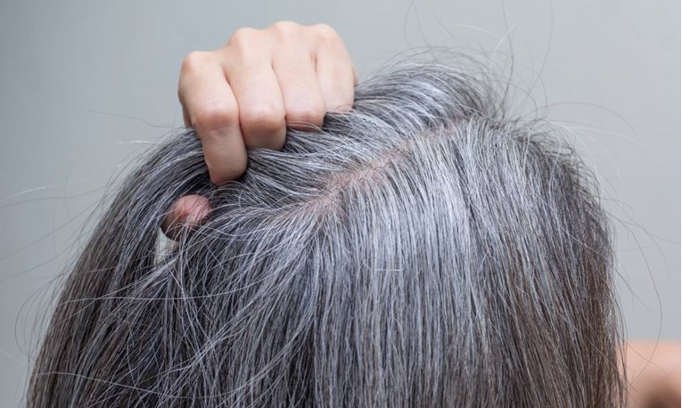 Znanstvenici otkrili zašto nam kosa sijedi i kako to možemo zaustaviti? 