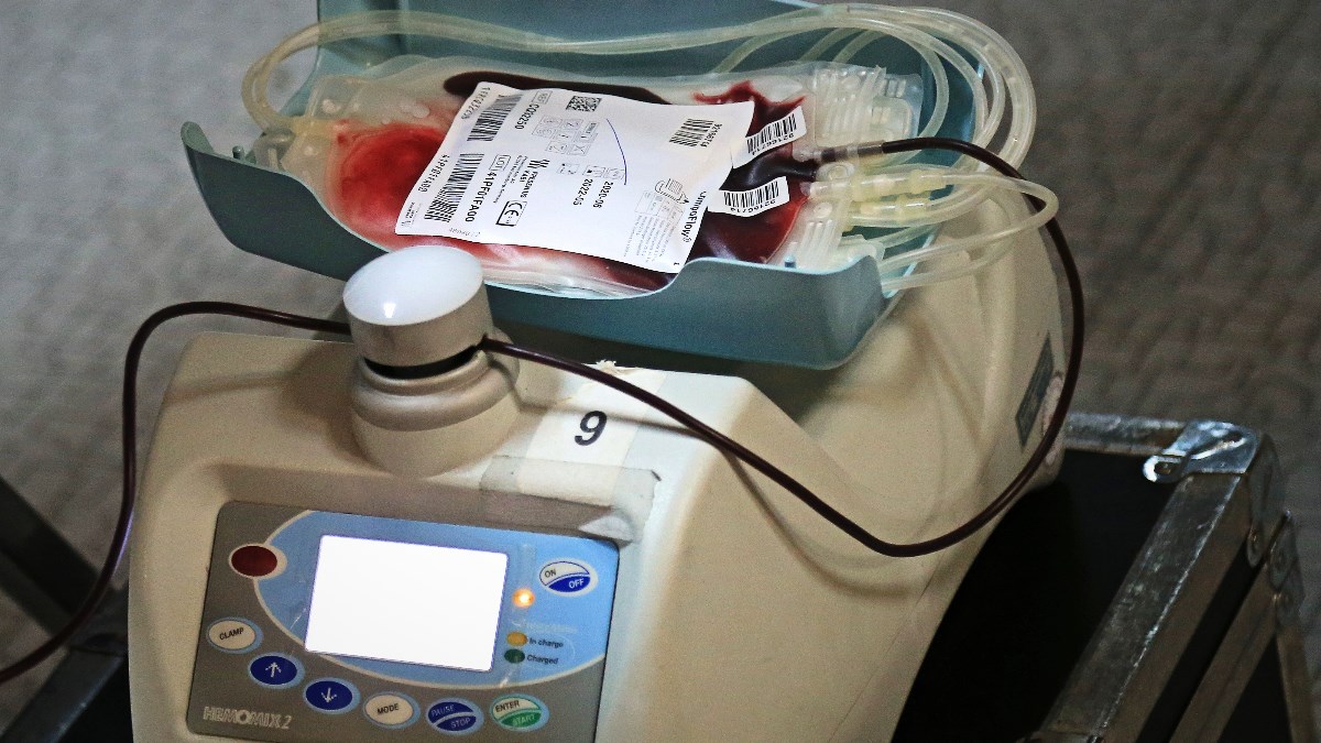 Varaždinskoj bolnici nedostaje zalihe krvi, posebno 0 i A