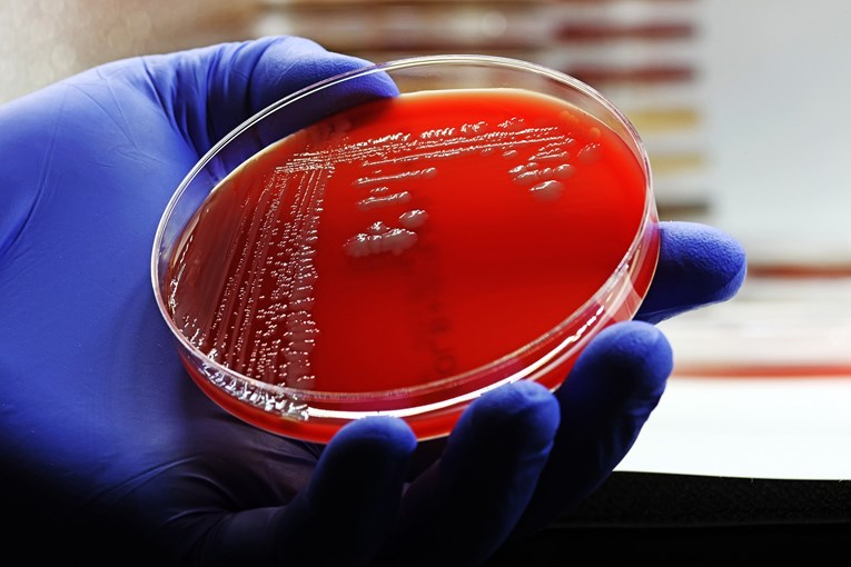 Tiha pandemija prijeti svijetu: Cijena otpornosti na antibiotike bit će golema