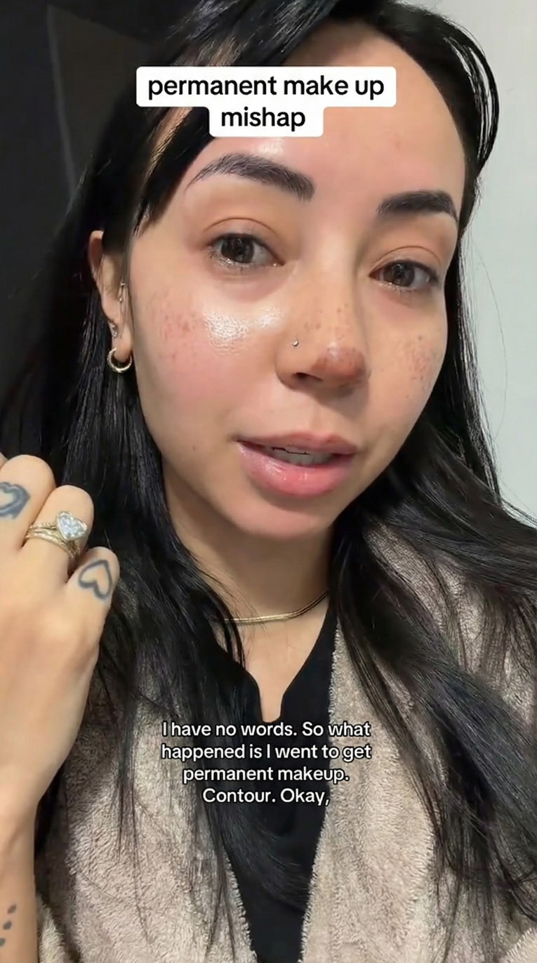 Otišla na trajno konturiranje nosa pa pokazala rezultat, ljudi umiru od smijeha