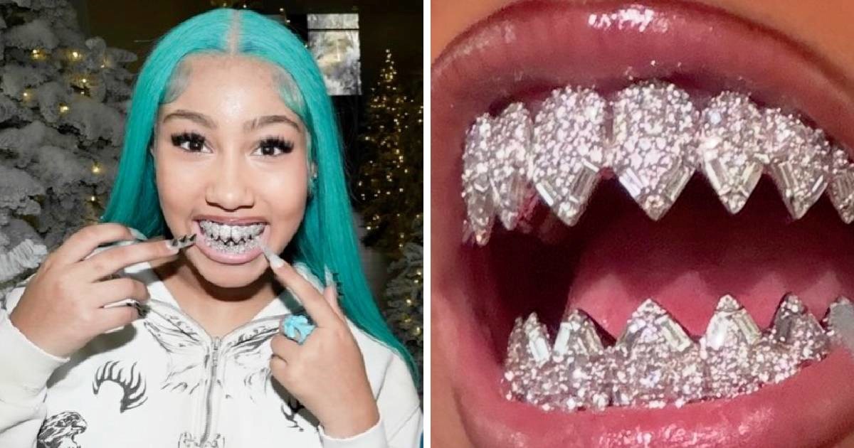 "Ovo nije normalno": North West (12) pokazala novi dijamantni dodatak na zubima