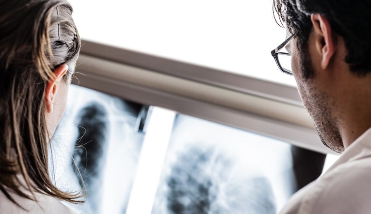 Istraživanje: Novi lijek prepolovio rizik od smrti od najčešće vrste raka pluća