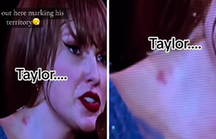 Fanovi primijetili neobičan trag na vratu Taylor Swift i sad nagađaju o čemu je riječ