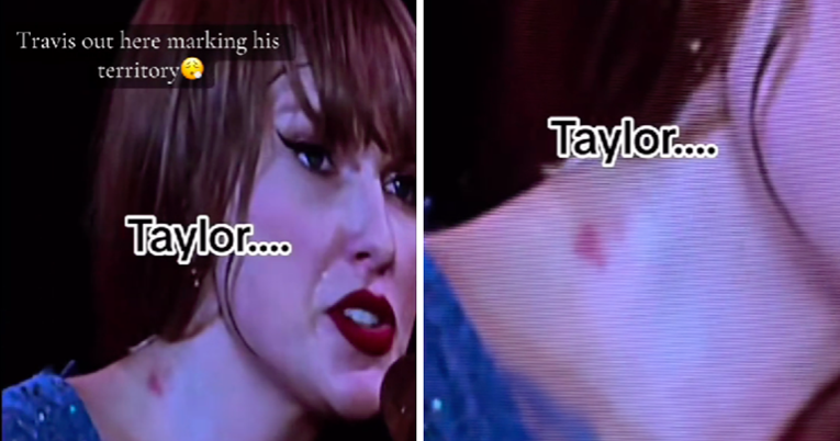 Fanovi primijetili neobičan trag na vratu Taylor Swift i sad nagađaju o čemu je riječ