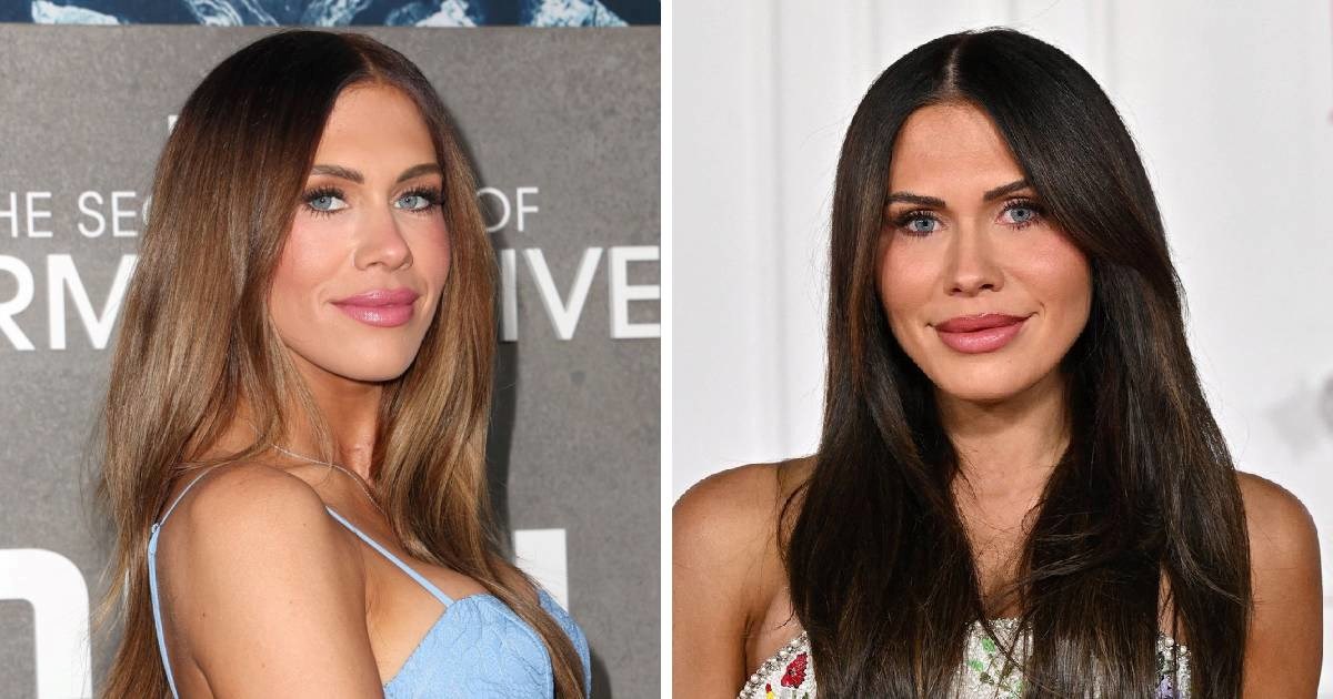 Reality zvijezda: "Estetska operacija od 23.000 eura uništila mi je život i karijeru"