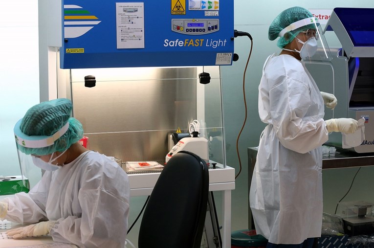 Japanski znanstvenici razvili test za rano upozorenje na teže slučajeve koronavirusa