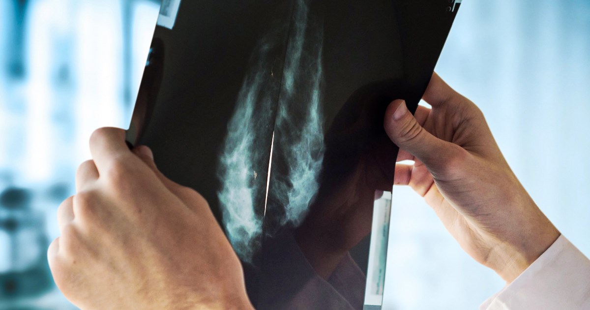 Revolucionarna tehnika postojećim lijekovima sprječava vraćanje raka