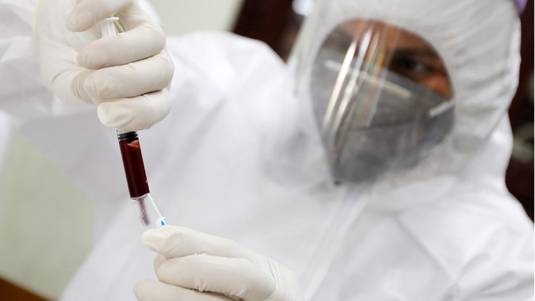 Virus ušao u karlovački Zavod za hitnu medicinu