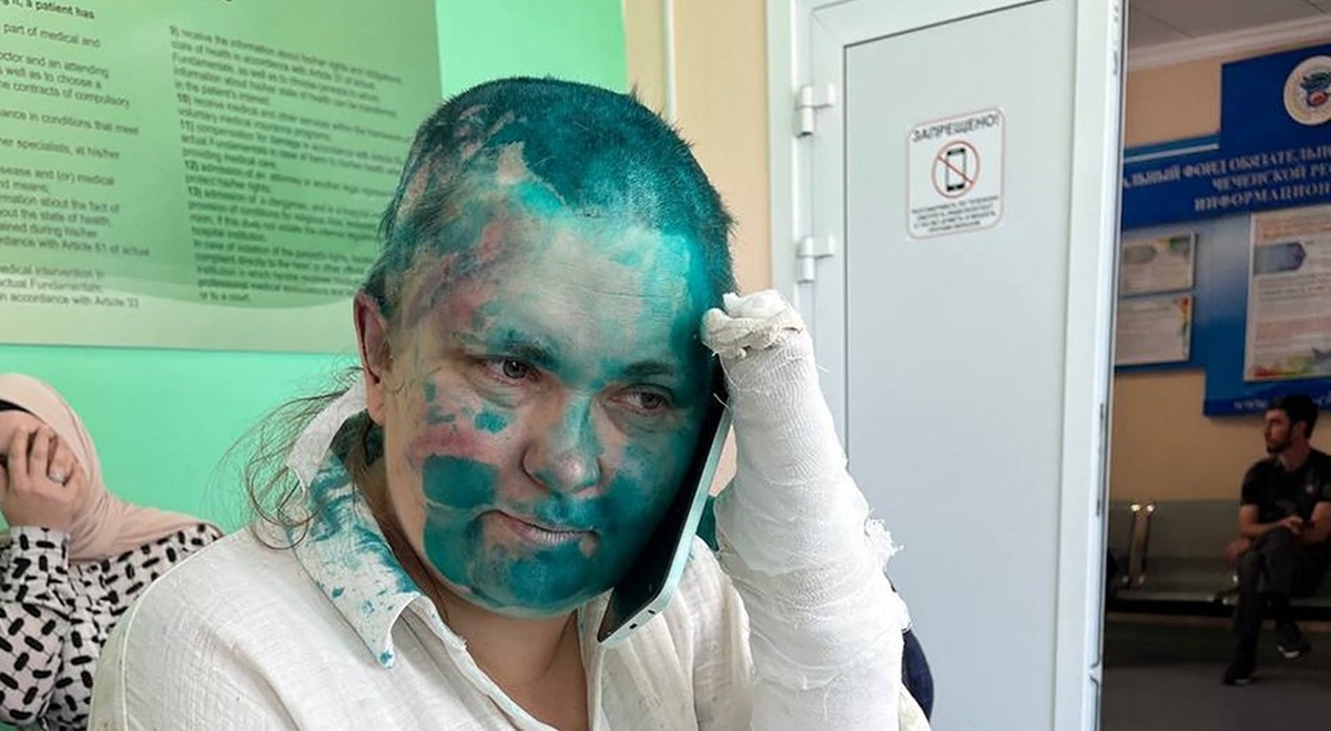 FOTO Ruska novinarka i odvjetnik brutalno napadnuti u Čečeniji
