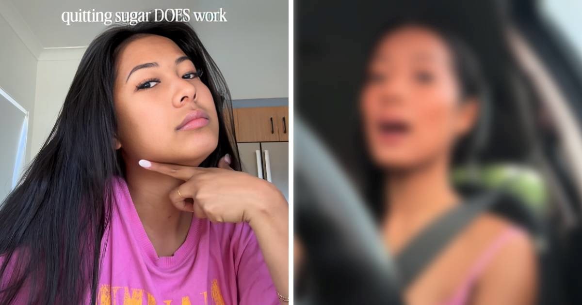 Izbacila je rafinirani šećer iz prehrane pa pokazala svoje tijelo prije i poslije