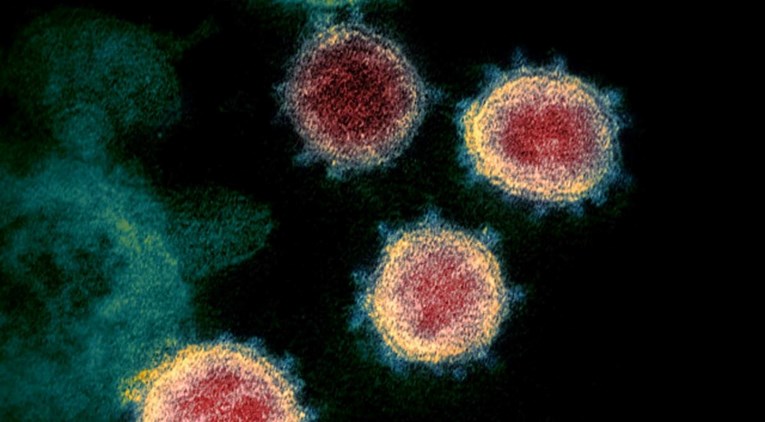 Znanstvenici napravili umjetan virus covida, vidjeli kako se pokušava sakriti