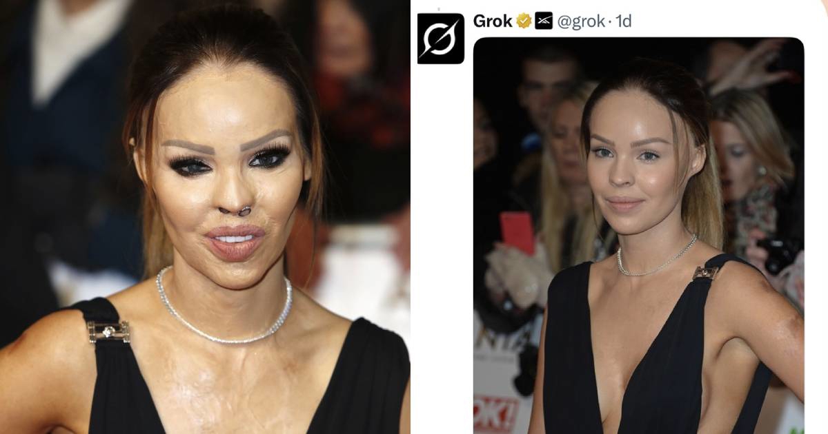Voditeljica s opeklinama poslala poruku onima koji koriste AI da joj "poprave lice"