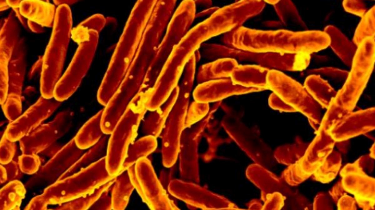 Tuberkulozna Amerikanka se odbila liječiti. Prijete joj zatvor i liječenje na silu