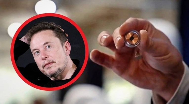 Musk: Ugradili smo čip u mozak čovjeka