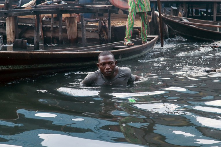 Od kolere u Nigeriji umrlo 40 ljudi, preko 3000 ih je zaraženo