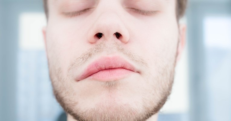 Drugi je uzrok smrtnosti u Hrvatskoj: Ovo su najčešći simptomi moždanog udara