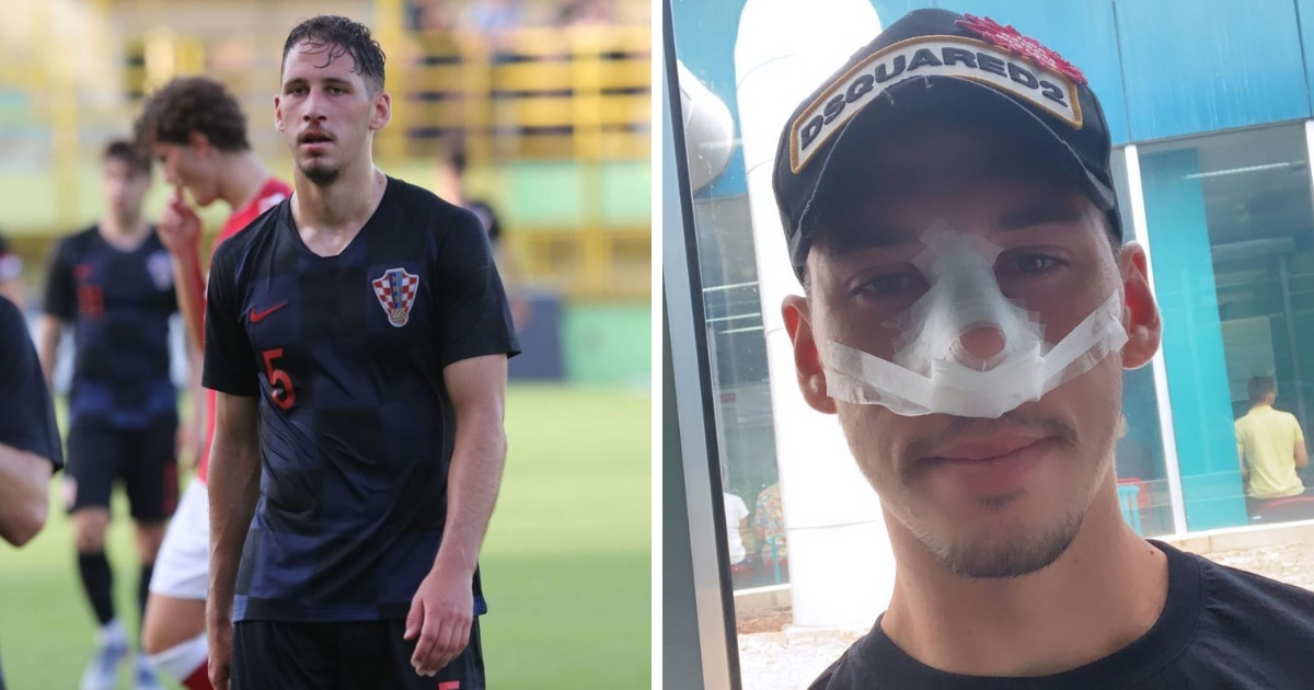 Važna lekcija slomljene momčine s maskicom