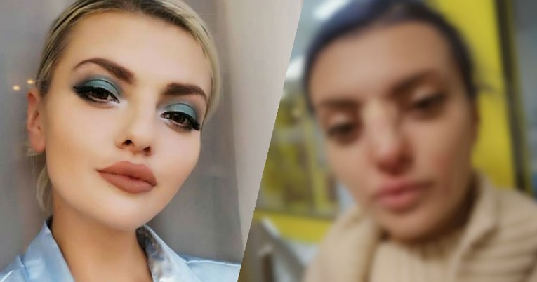 Ella Dvornik završila na hitnoj s krvavim nosom