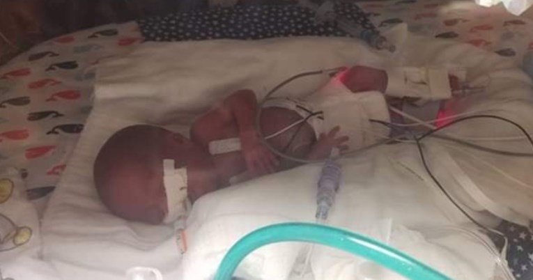 Četiri mjeseca prije termina rodila bebu tešku tek 360 grama: “Naše malo čudo"