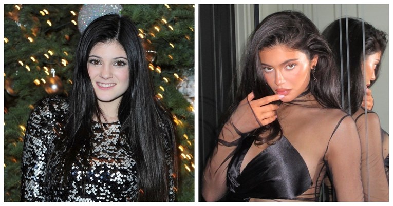 Nakon godina nijekanja Kylie Jenner konačno priznala da je imala plastičnu operaciju