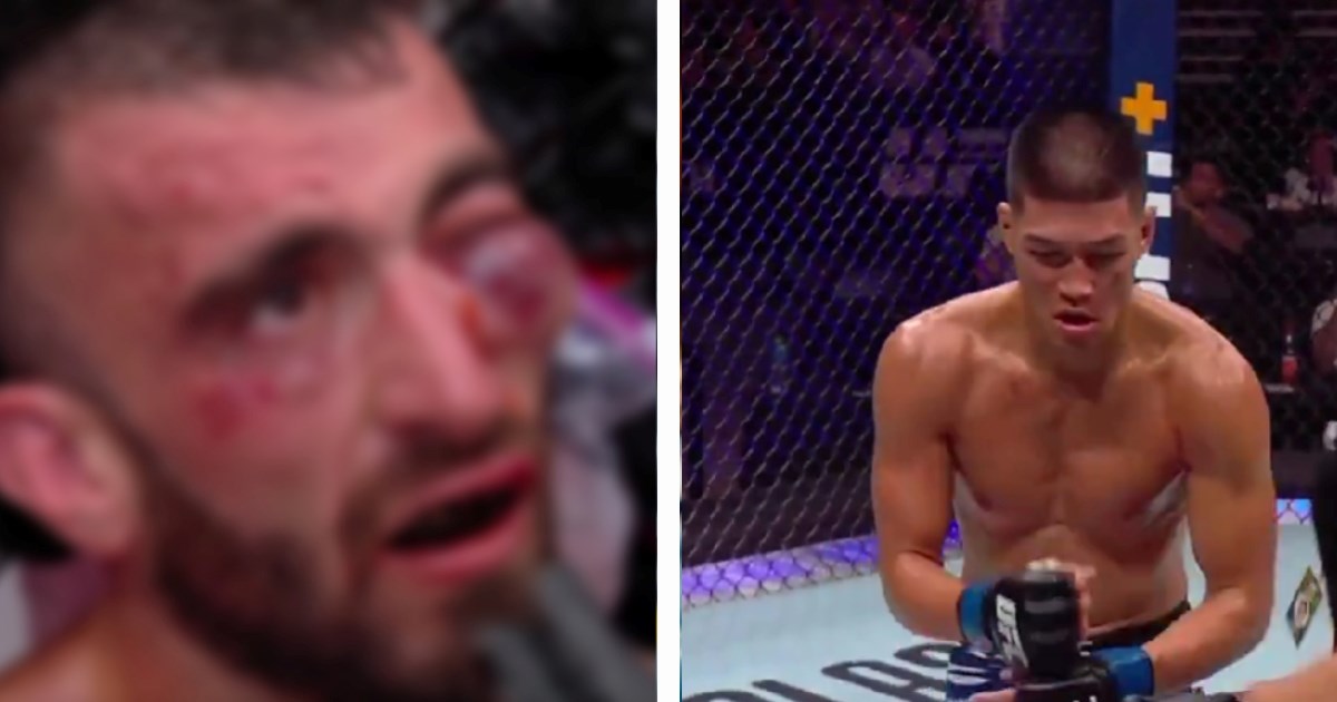 VIDEO UZNEMIRUJUĆE Borac doživio jednu od najružnijih ozljeda u povijesti UFC-a