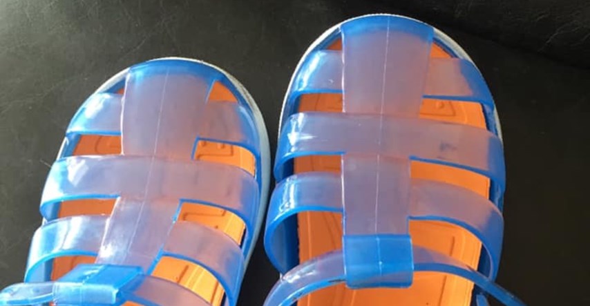 Mama kupila sinu gumene sandale pa objavila fotografije stravičnih krvavih rana