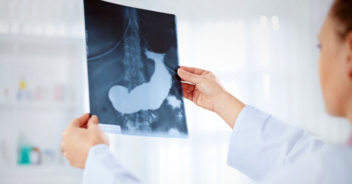 Istražuje se cjepivo za jedan od najsmrtonosnijih rakova. Znanstvenici: Obećavajuće