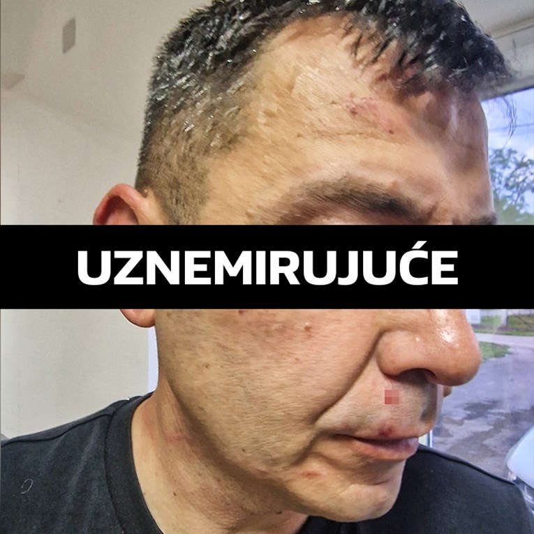 Skandal u BiH. Predsjednik kluba sa sinom ušao u svlačionicu i pretukao suca