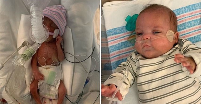Čudesna beba rođena sa samo 453 grama ide kući nakon 133 dana u bolnici