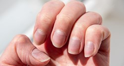 Jedan simptom može ukazivati na lošu cirkulaciju, a vidljiv je na noktima