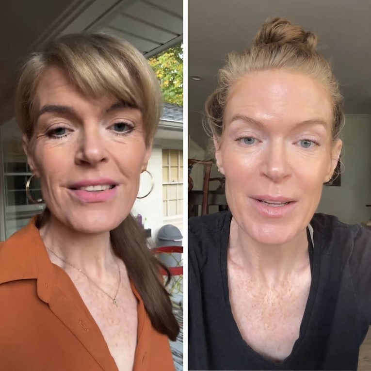Žena (40) pokazala transformaciju nakon što su joj rekli da izgleda starije od 50