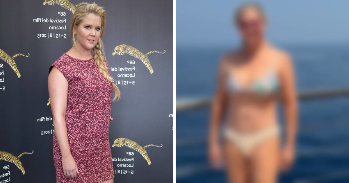 Amy Schumer (45) pokazala kako izgleda nakon gubitka 25 kilograma