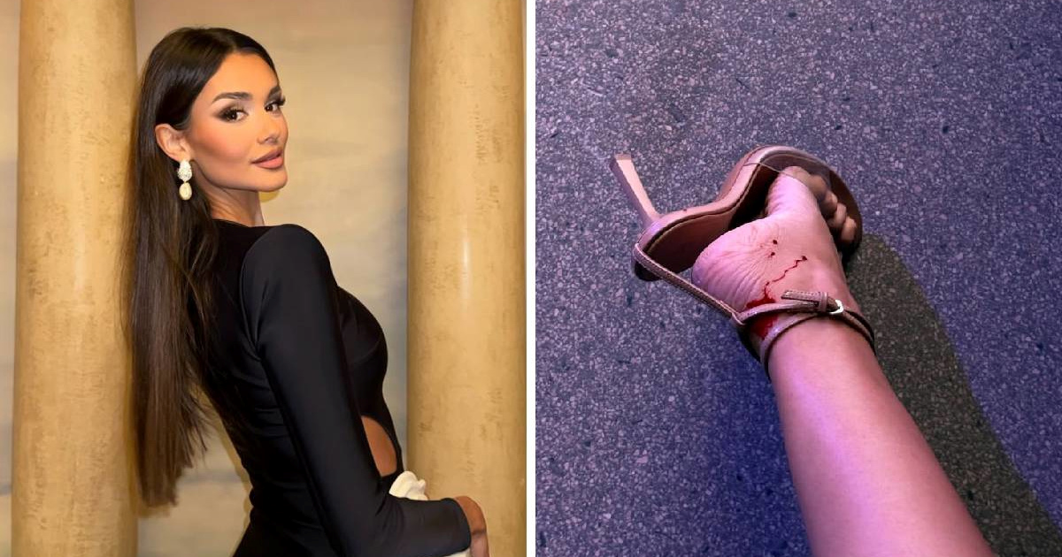 Laura Gnjatović pokazala krvavo stopalo nakon zadarske revije