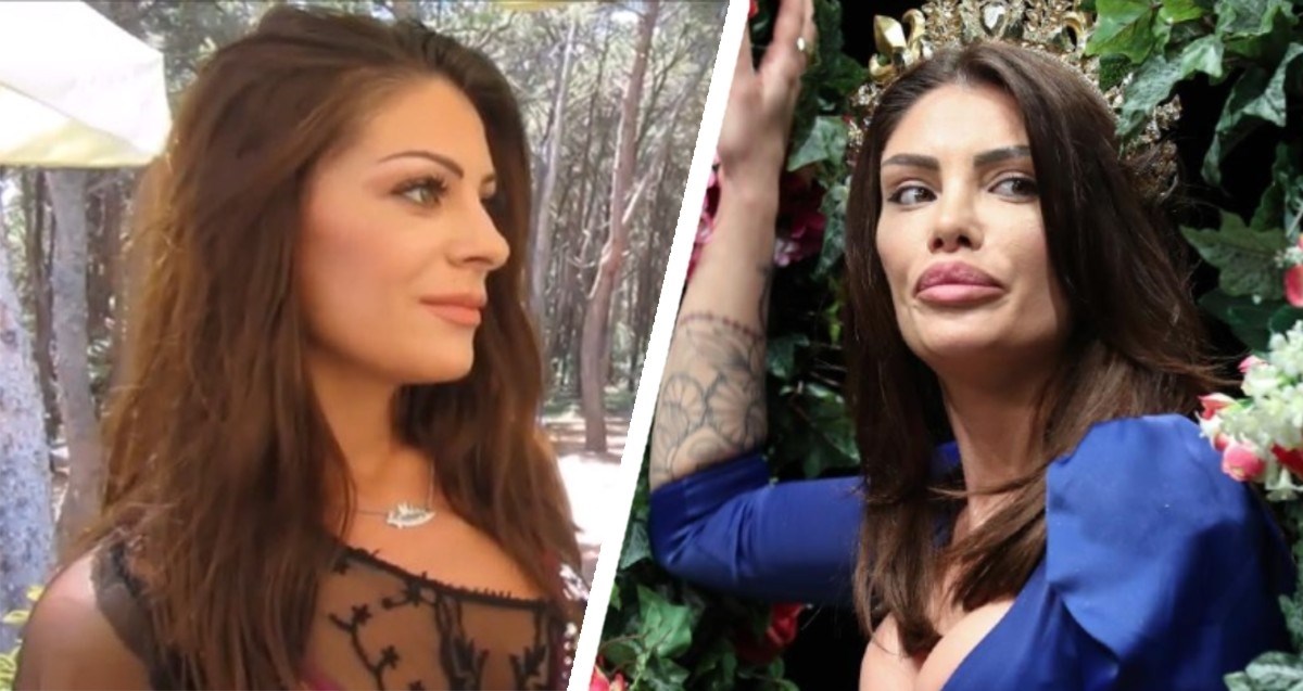 Hrvatska misica iznenadila izgledom lica, operirala je usne, nos, oči...