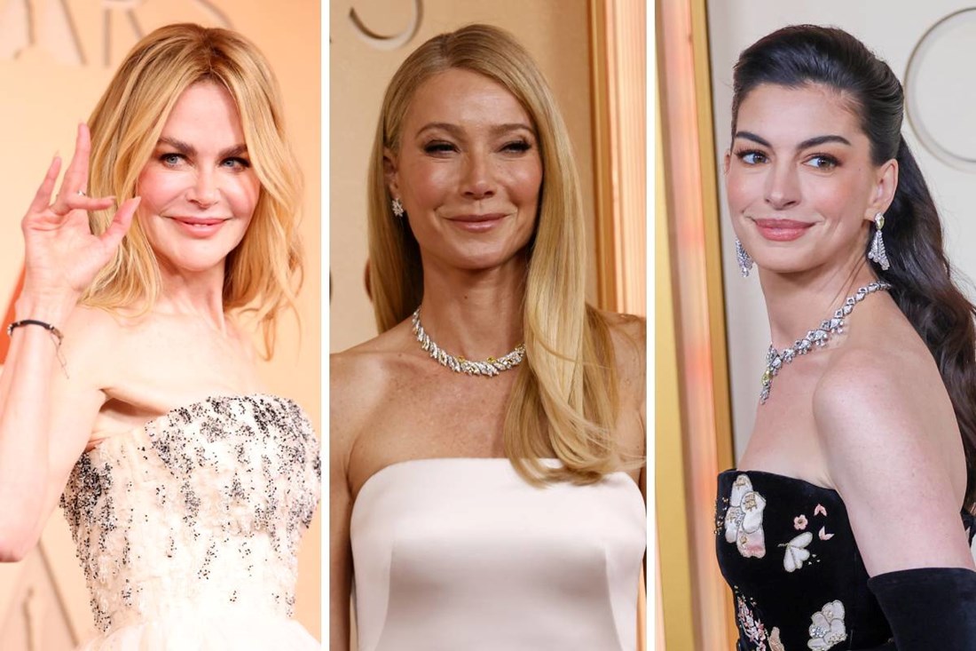 Nakon Oscara kozmetičari i kirurzi pričaju o "novom licu Hollywooda". Što je to?