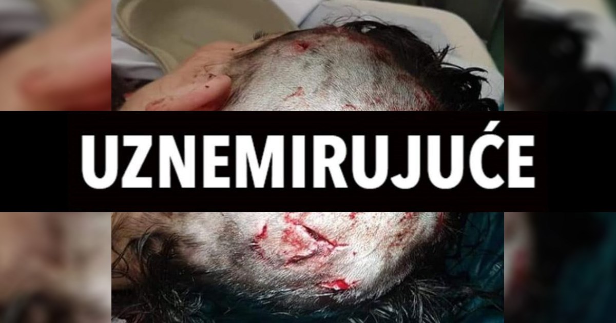 UZNEMIRUJUĆE Nasilnik koji je ženi nanio ovakve ozljede uskoro će na slobodu