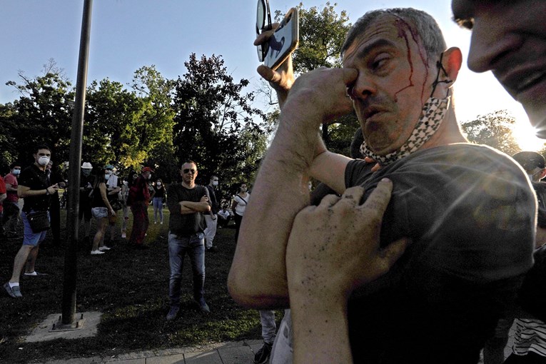 U masovnim prosvjedima u Beogradu ozlijeđeno 19 policajaca i 17 prosvjednika