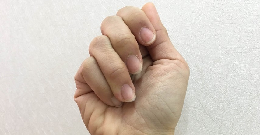 Što znače brazde na noktima i kad je vrijeme za odlazak liječniku?