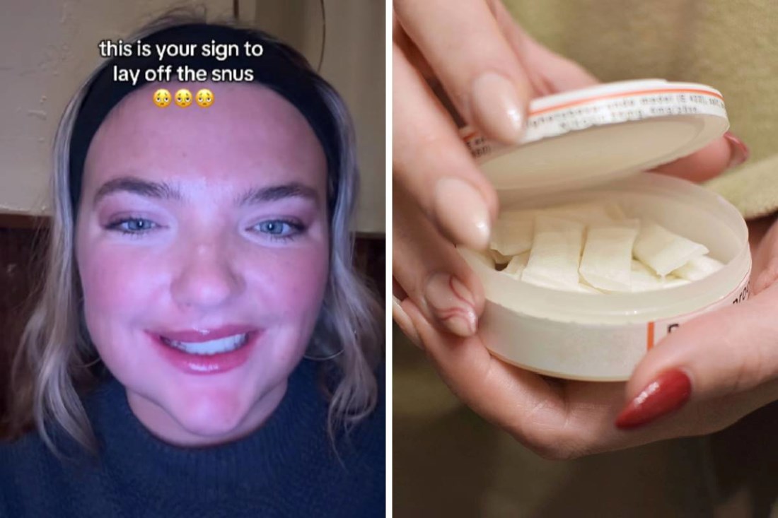 Pokazala je posljedice uzimanja snusa. Taj nikotinski proizvod mladi sve više koriste