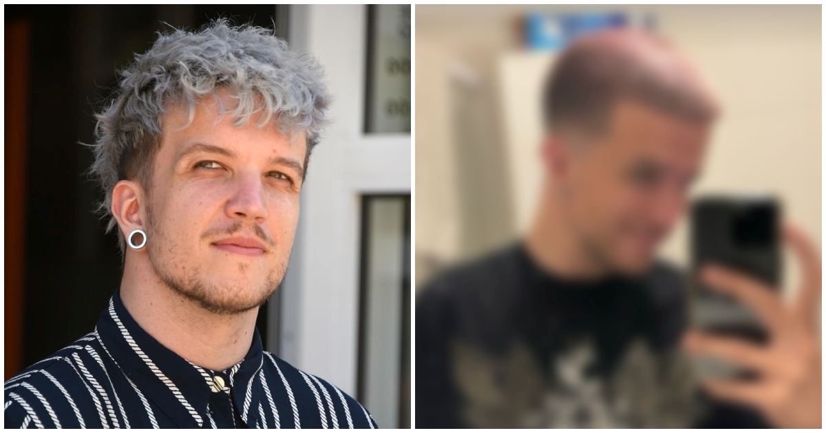 Baby Lasagna iznenadio fanove promjenom imidža, ima novu boju kose