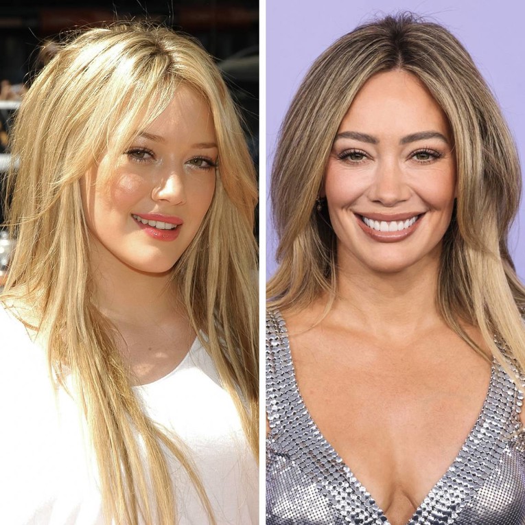 Hilary Duff: Obožavam botoks i tretmane spermom lososa, i moj muž to voli